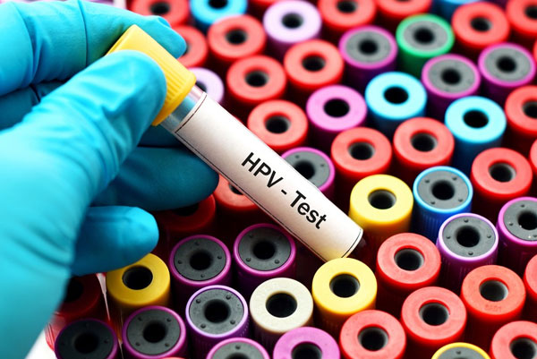 test-hpv